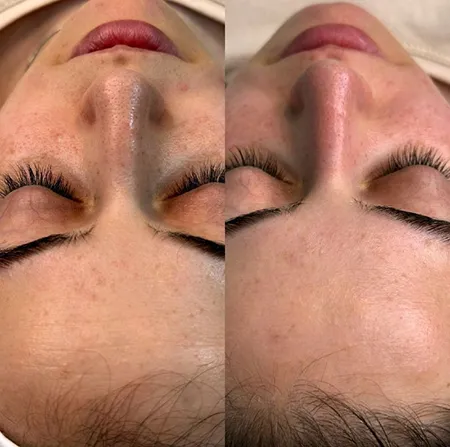 انواع پاکسازی پوست در آرایشگاه